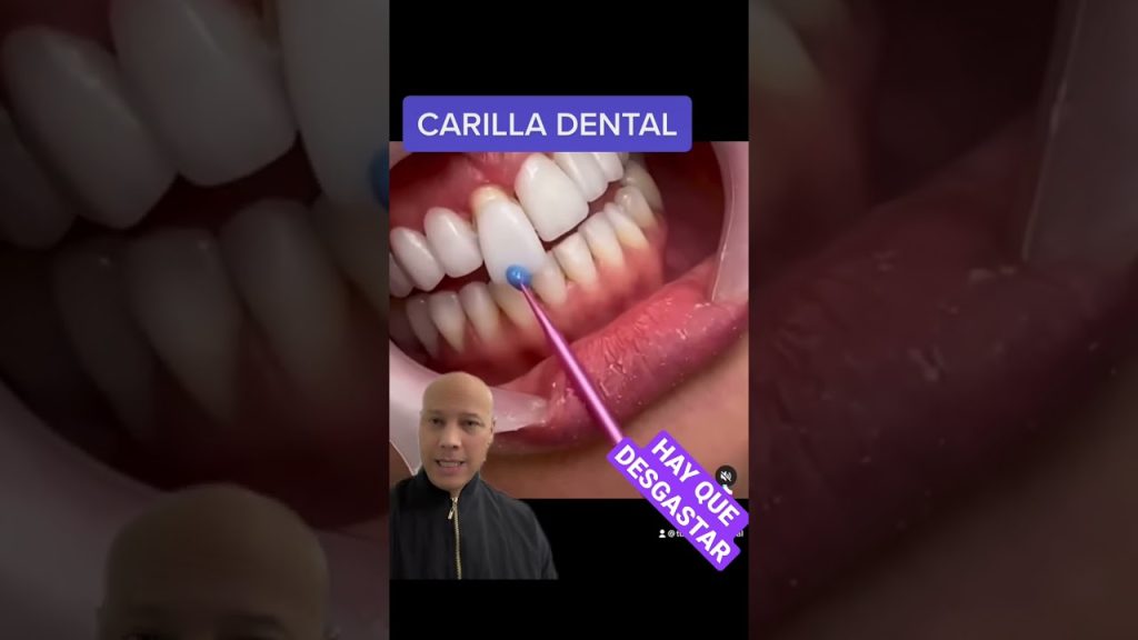 Dentista en  Casas del Monte